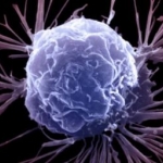 Британские ученые нашли новый способ победить рак
